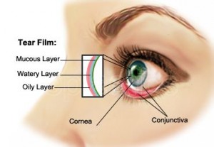 dry-eye-syndrome-1